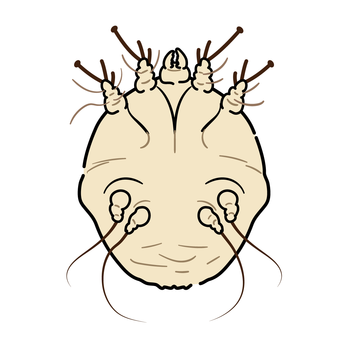 通常疥癬と角化型疥癬の比較