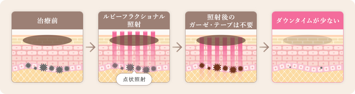 ルビーフラクショナルの特徴