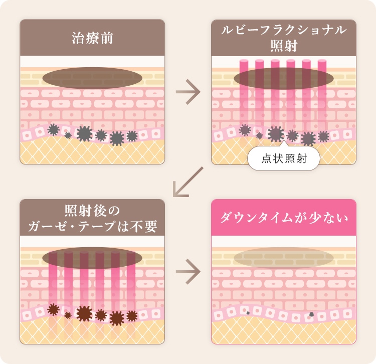 ルビーフラクショナルの特徴